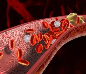 中暑後遺症、熱衰竭