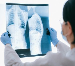 阿茲海默症、失智症、欣智樂、樂意保